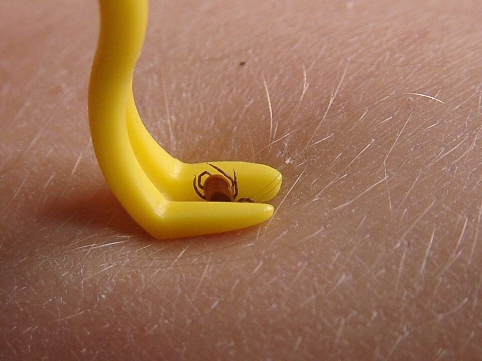 A tick removal tool gripping a tick close to the skin, showing the correct removal technique